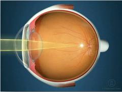 15 сентября – День здоровья школьников: Профилактика нарушения зрения